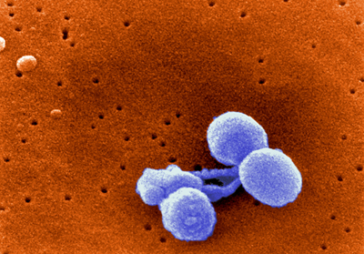 Scanning Electron Micrograph of Streptococcus pneumoniae.: Streptococcus pneumoniae is a leading cause of serious illness among young children worldwide and is the most frequent cause of pneumonia, bacteremia, sinusitis, and acute otitis media (AOM). Widespread overuse of antibiotics contributes to emerging drug resistance. Photograph by courtesy of CDC